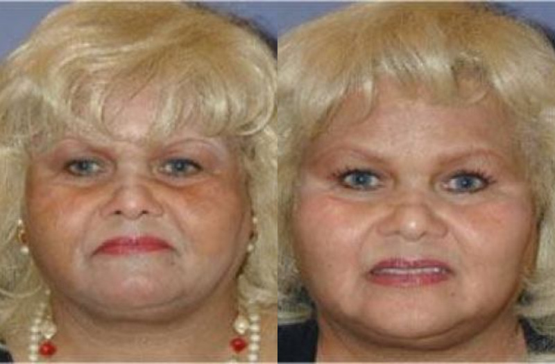 Complexion Blending 5 Combine Image